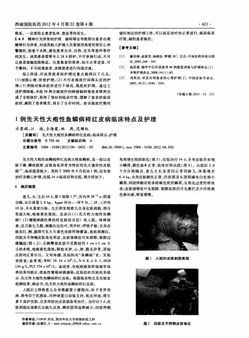 1例先天性大疱性鱼鳞病样红皮病临床特点及护理