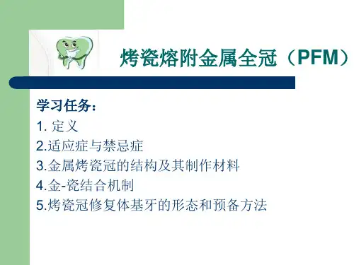 烤瓷熔附金属全冠