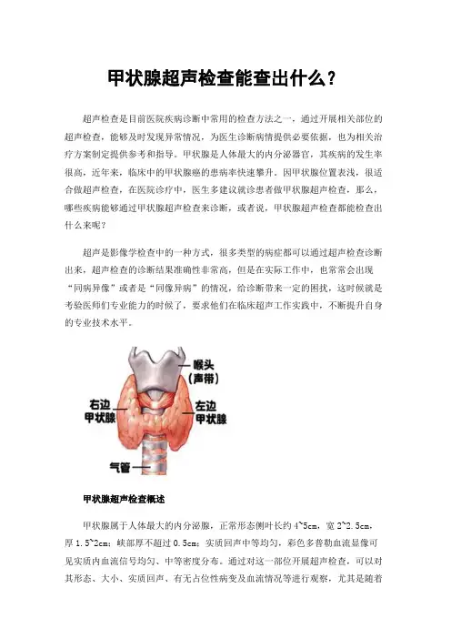 甲状腺超声检查能查出什么？