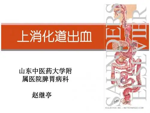 上消化道出血最新诊治共识
