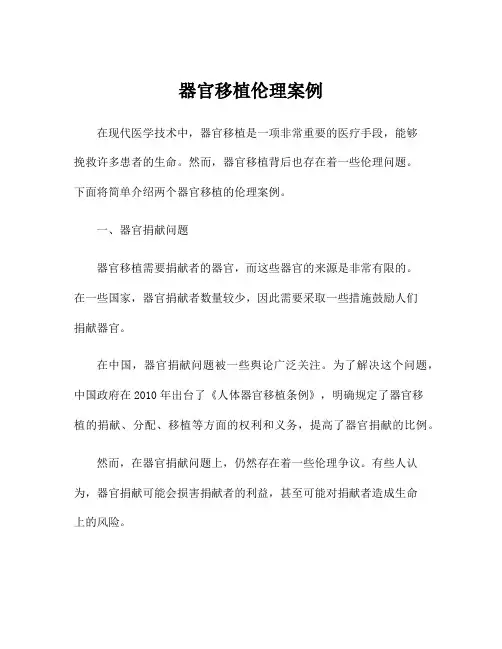 器官移植伦理案例