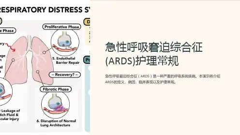 急性呼吸窘迫综合征(ARDS)护理常规