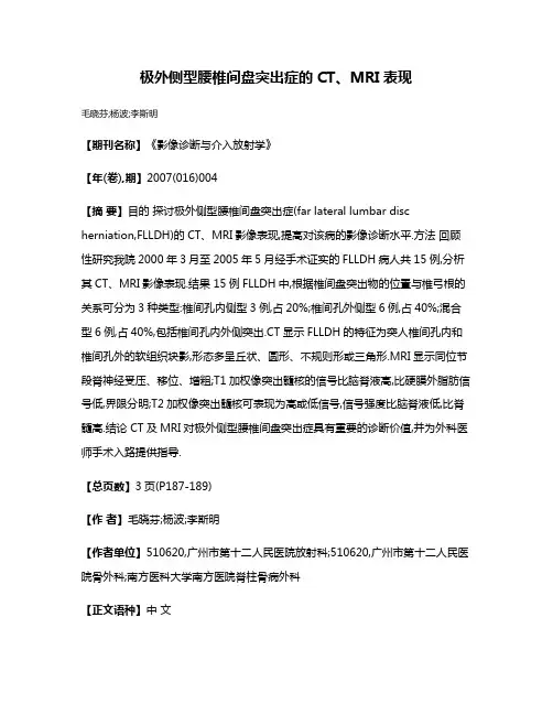 极外侧型腰椎间盘突出症的CT、MRI表现