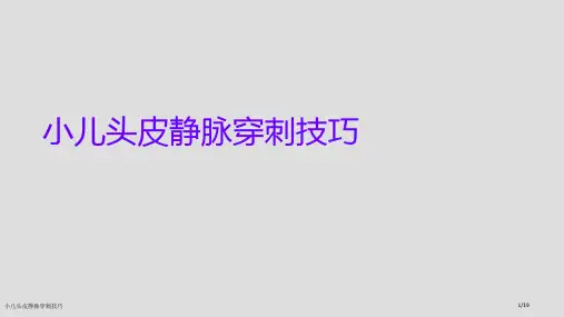 小儿头皮静脉穿刺技巧