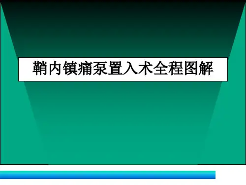 爱爱医资源-鞘内镇痛泵置入术全程图解.