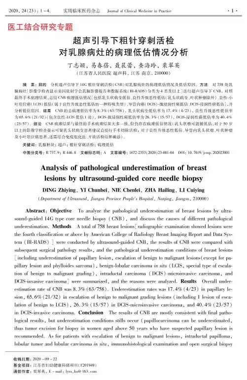 超声引导下粗针穿刺活检对乳腺病灶的病理低估情况分析