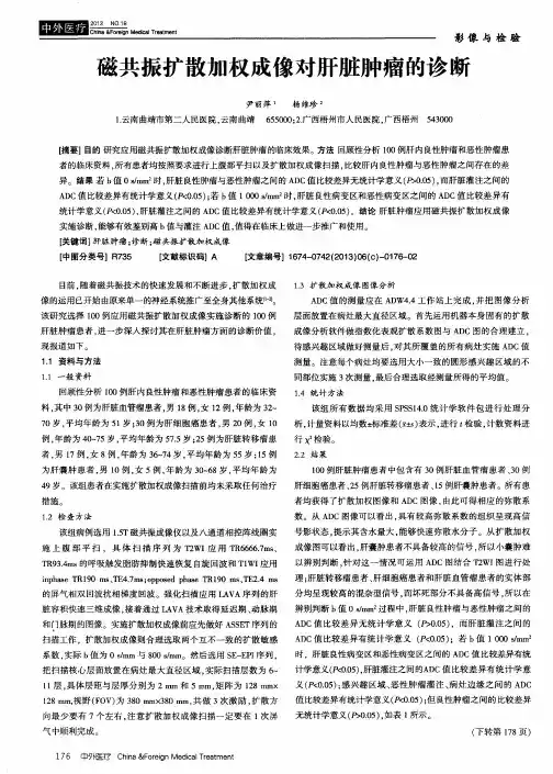 磁共振扩散加权成像对肝脏肿瘤的诊断