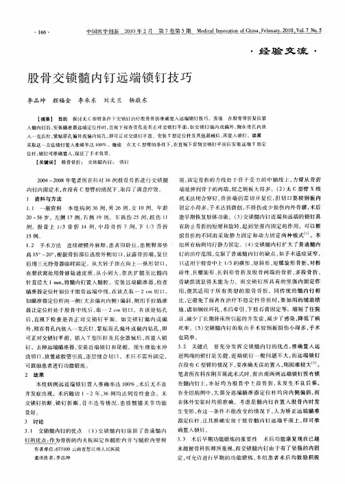 股骨交锁髓内钉远端锁钉技巧