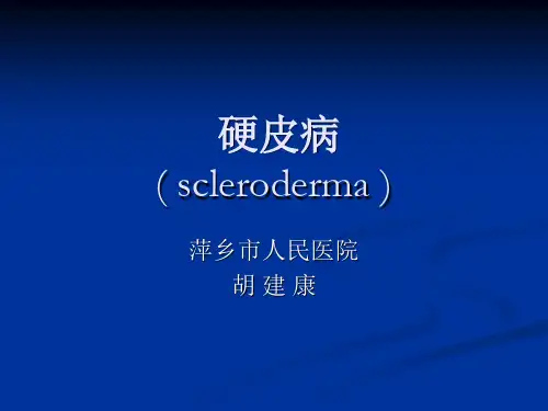 系统性硬化PPT课件