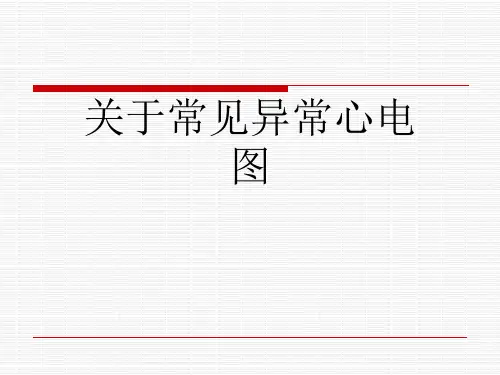 关于常见异常心电图