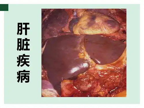 病理学教学课件：病毒性肝炎