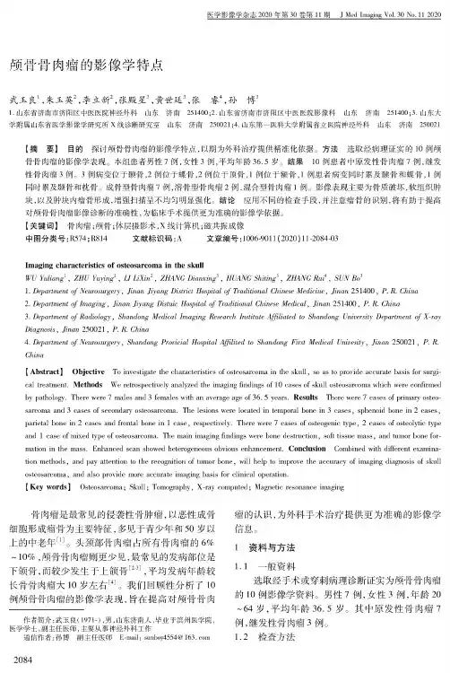 颅骨骨肉瘤的影像学特点