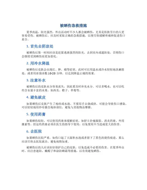 被晒伤急救措施