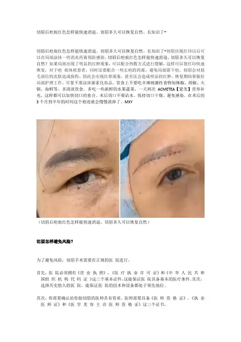 切眉后疤痕红色怎样能快速消退、切眉多久可以恢复自然、长知识了~