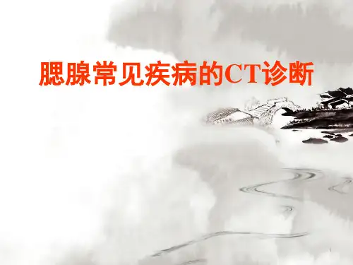 (精选课件)腮腺常见疾病的CT诊断PPT幻灯片