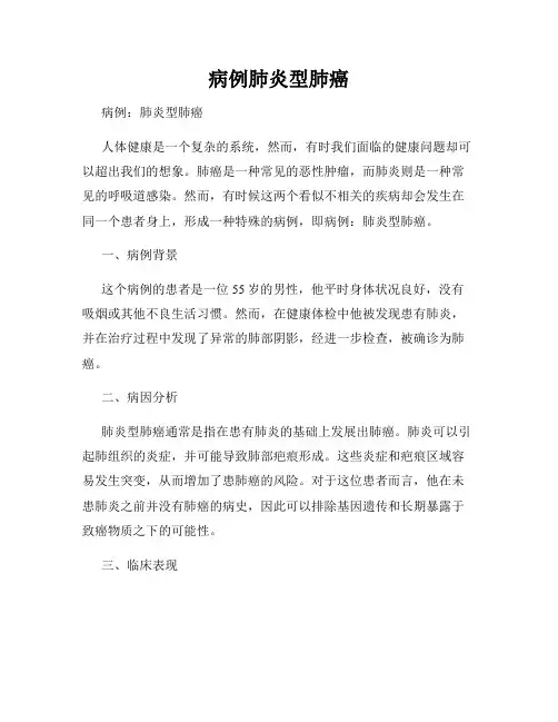 病例肺炎型肺癌