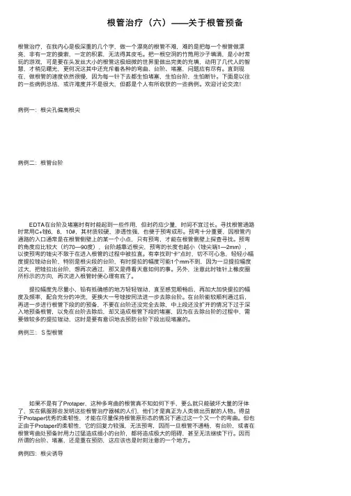 根管治疗（六）——关于根管预备