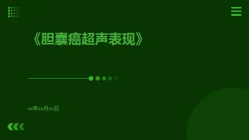 胆囊癌超声表现