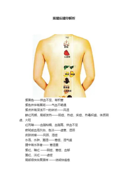 拔罐后罐印解析