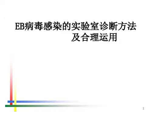 EB病毒感染的实验室诊断方法及合理运用PPT课件