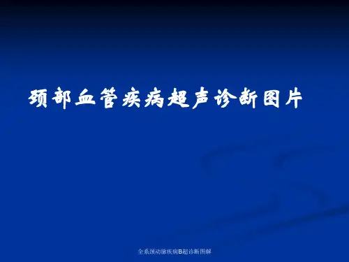 最新全系颈动脉疾病B超诊断图解