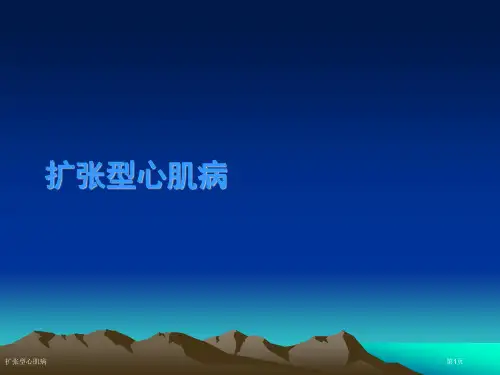 扩张型心肌病