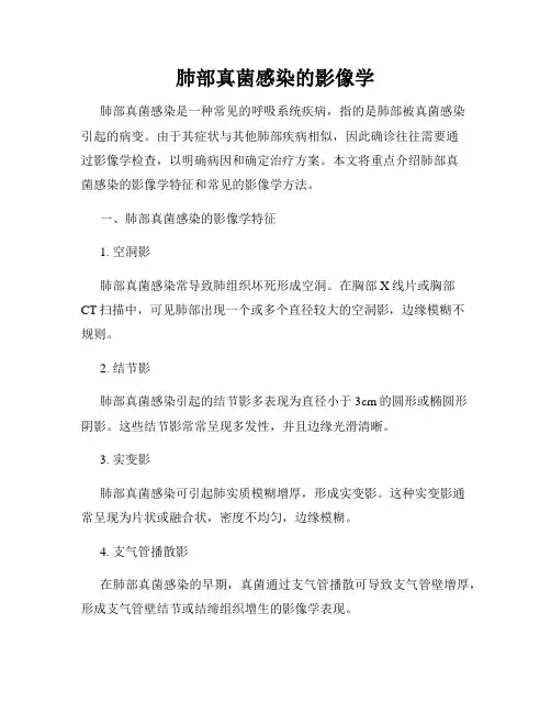 肺部真菌感染的影像学