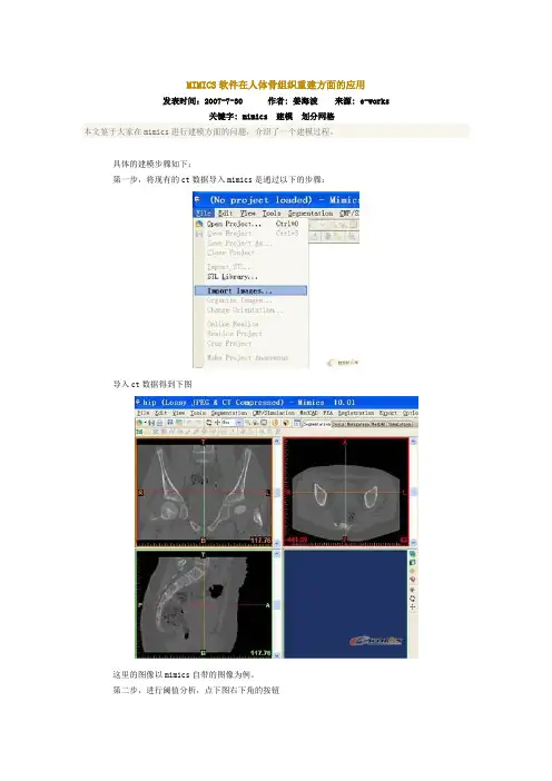 MIMICS软件在人体骨组织重建方面的应用