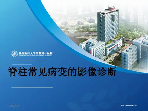 【医学PPT课件】脊柱常见病变的影像诊断PPT