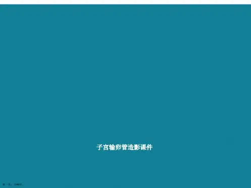 演示文稿子宫输卵管造影课件