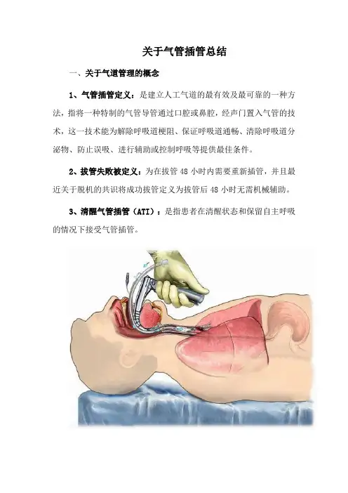 关于气管插管总结