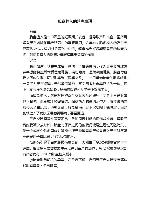 胎盘植入的超声表现