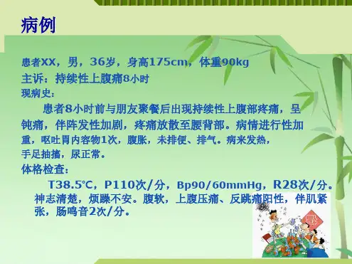 急性胰腺炎知识要点PPT(共52张PPT)