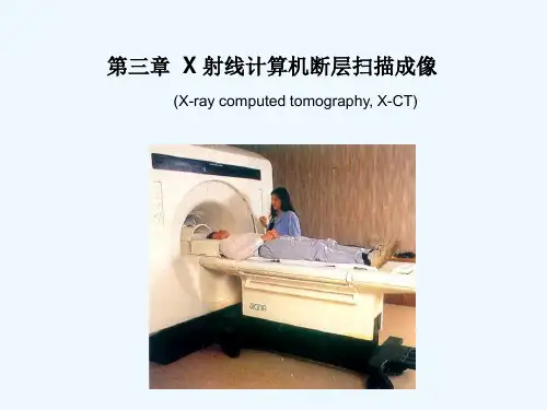 X 射线计算机断层扫描成像(55页)