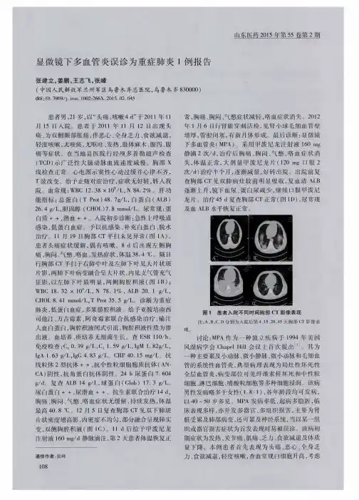 显微镜下多血管炎误诊为重症肺炎1例报告