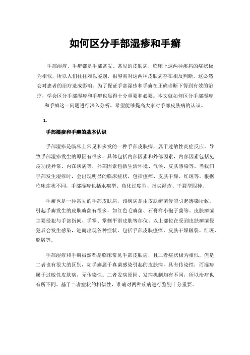 如何区分手部湿疹和手癣