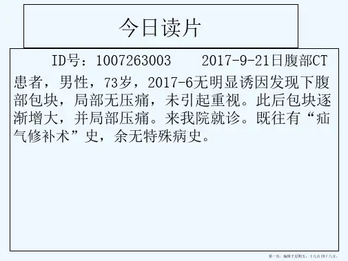 腹膜后脂肪肉瘤影像学表现与鉴别诊断
