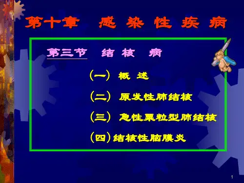 结核病ppt课件