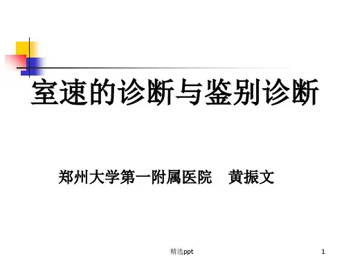 室速的诊断与鉴别诊断