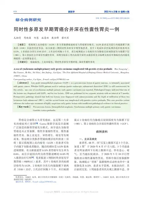 同时性多原发早期胃癌合并深在性囊性胃炎一例