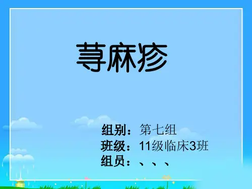 荨麻疹 ppt课件