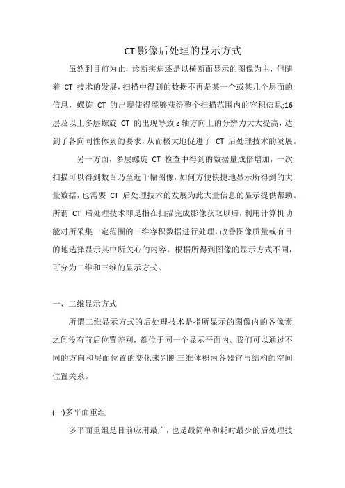 CT影像后处理的显示方式