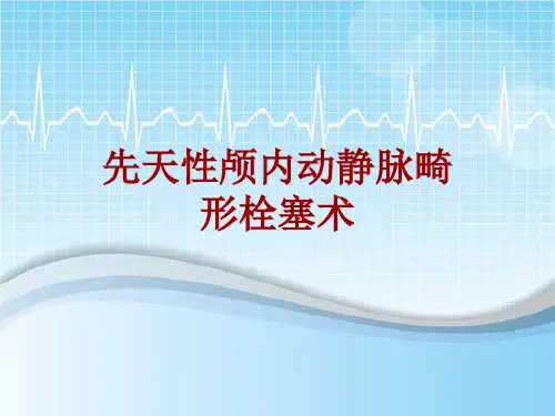 手术讲解模板：先天性颅内动静脉畸形栓塞术