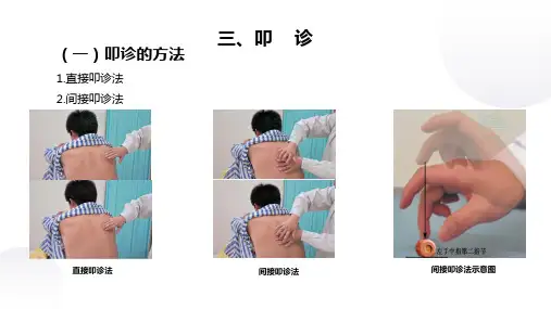 诊断学 胸部检查 肺和胸廓的叩诊(临床诊疗课件)