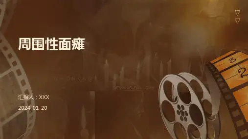 周围性面瘫演示课件