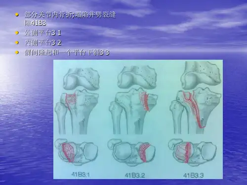 骨折与脱位诊断分型及治疗讲义
