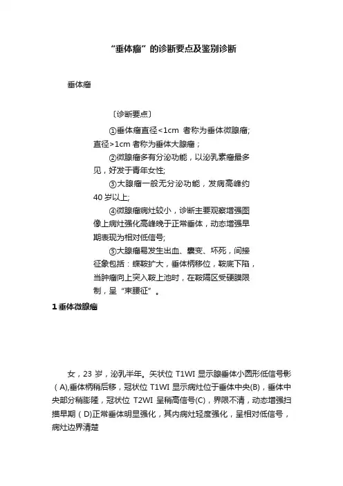 “垂体瘤”的诊断要点及鉴别诊断