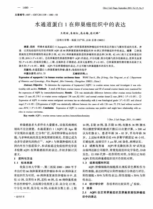 水通道蛋白1在卵巢癌组织中的表达