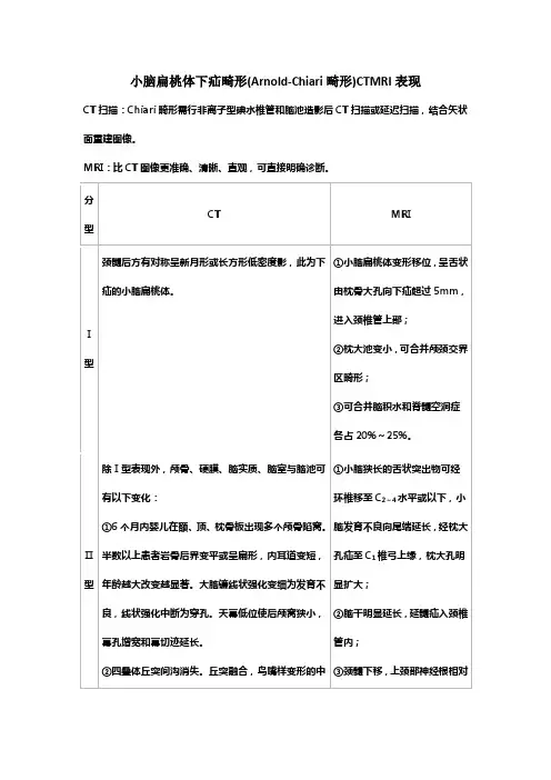 小脑扁桃体下疝畸形(Arnold-Chiari畸形)CTMRI表现