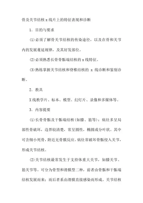 骨及关节结核x线片上的特征表现和诊断